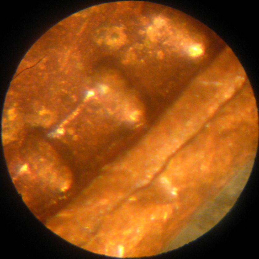 Dommage au coin aux denticules.jpg
